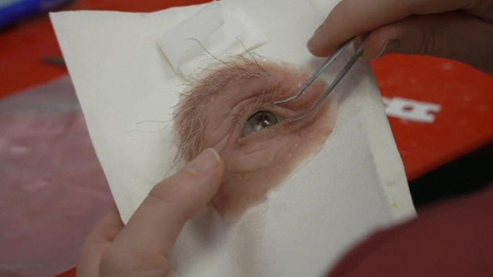 Prosthetic eye