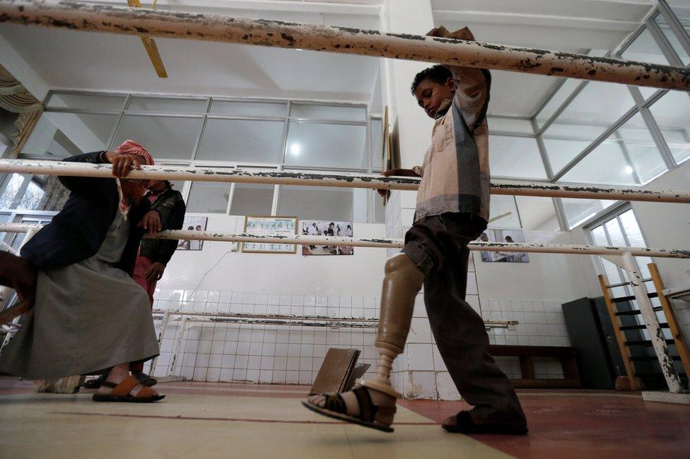 Salah Hassan Abdullah, 13, who lost his leg after a mortar shell hit his village in Yemen's Taiz province, tests an artificial leg at a prosthetic limb centre in Sanaa, Yemen (16 January 2017