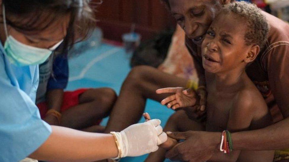 Nurse treats young boy in Papua.