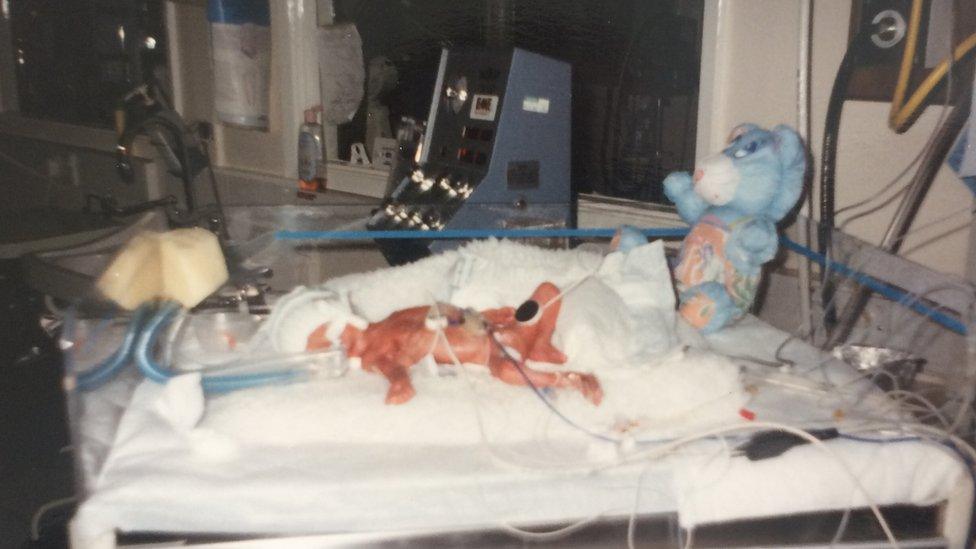 One of the triplets on the neonatal ward