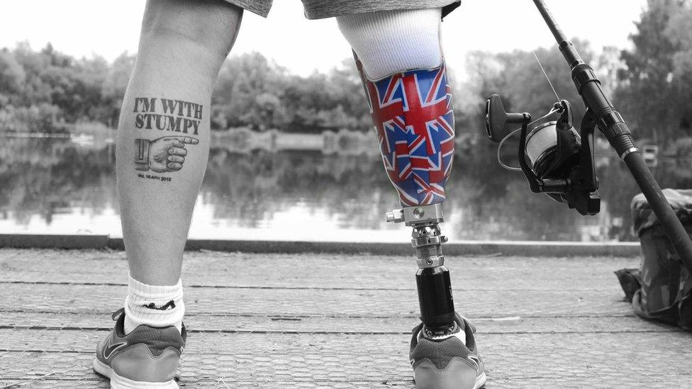 Fisherman with prosthetic leg next to a lake