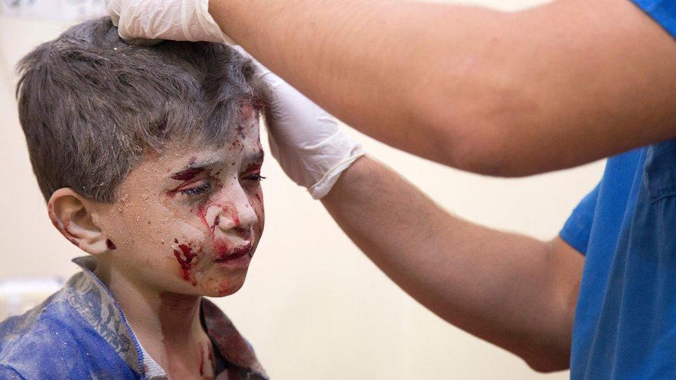 A Syrian boy receives treatment at a make-shift hospital following air strikes on rebel-held eastern areas of Aleppo in September