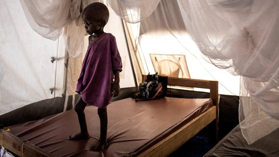 A severely malnourished child stands on his bed inside a feeding and rehabilitation centre on October 23, 2017 in Tshikapa