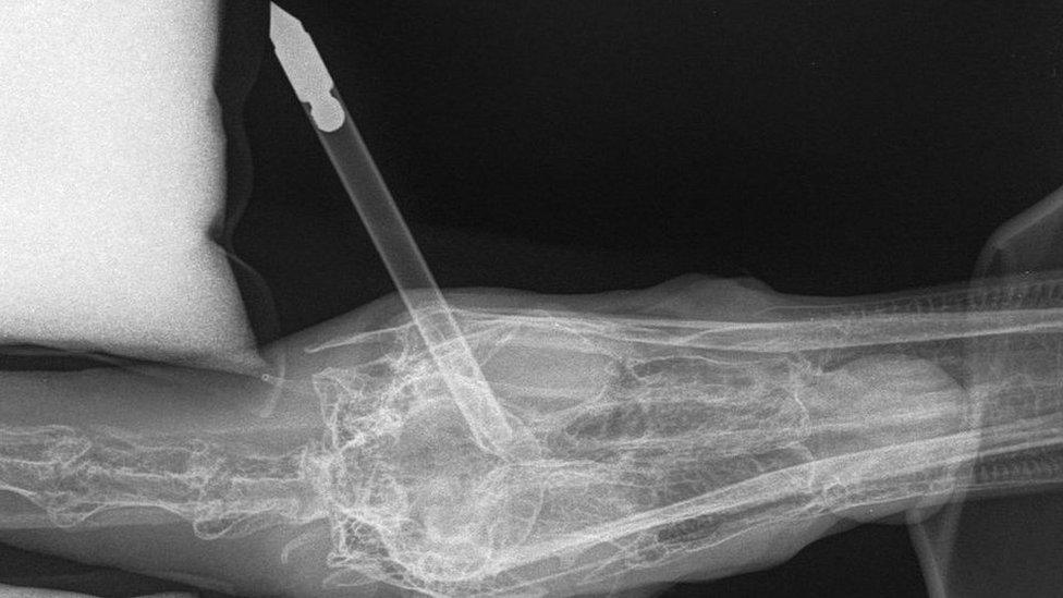 Injured swan