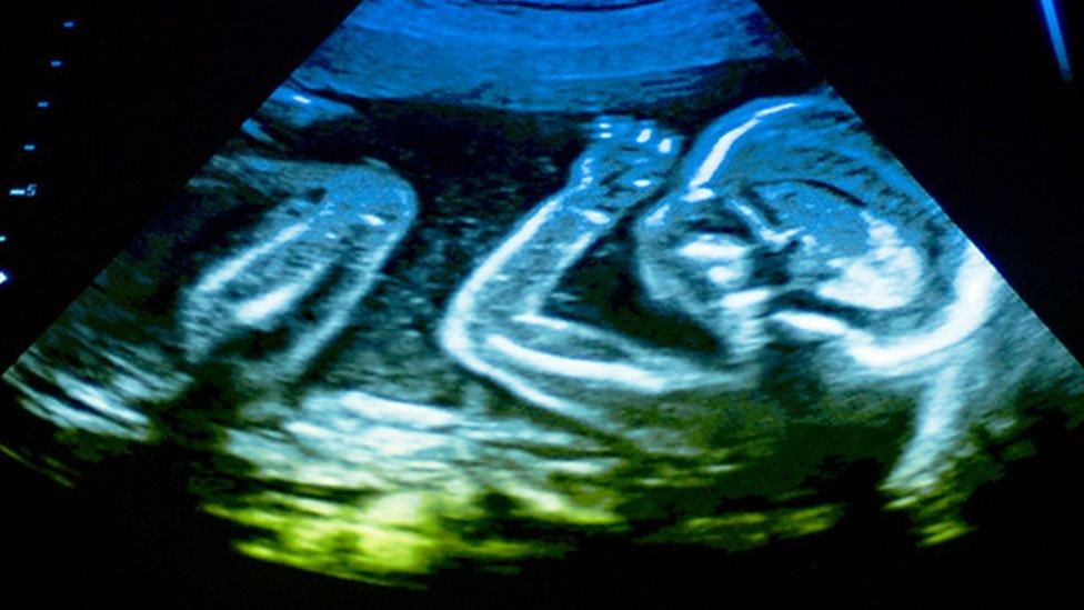 Baby ultrasound scan