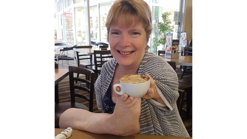 Trish Jackson, who has very short arms, holds a coffee cup with her foot