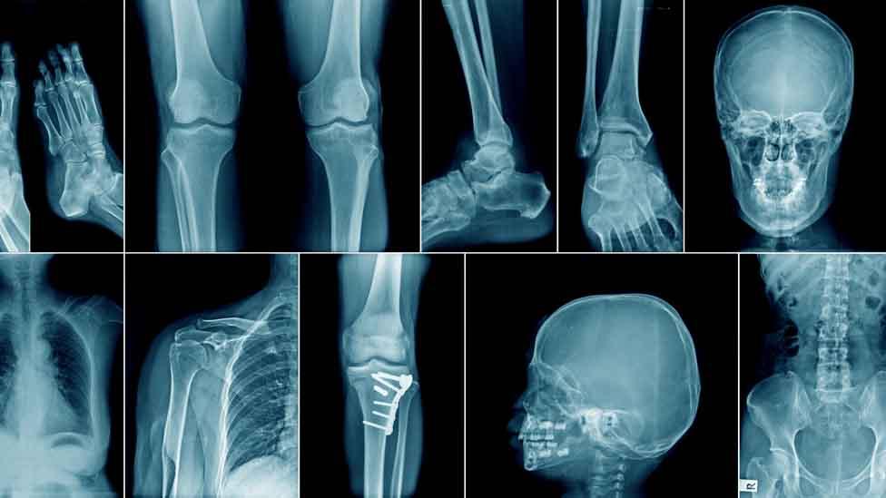 Various X-rays