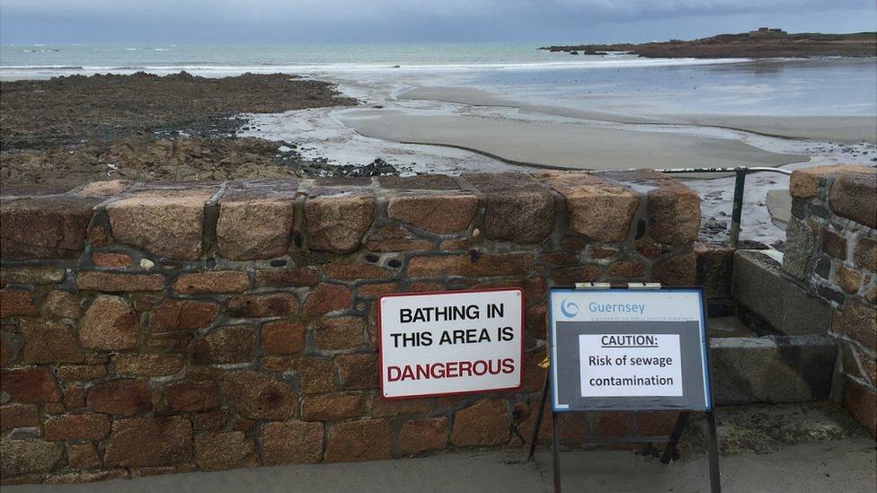 Signs warning of sewage on the beach at Vazon, Guernsey