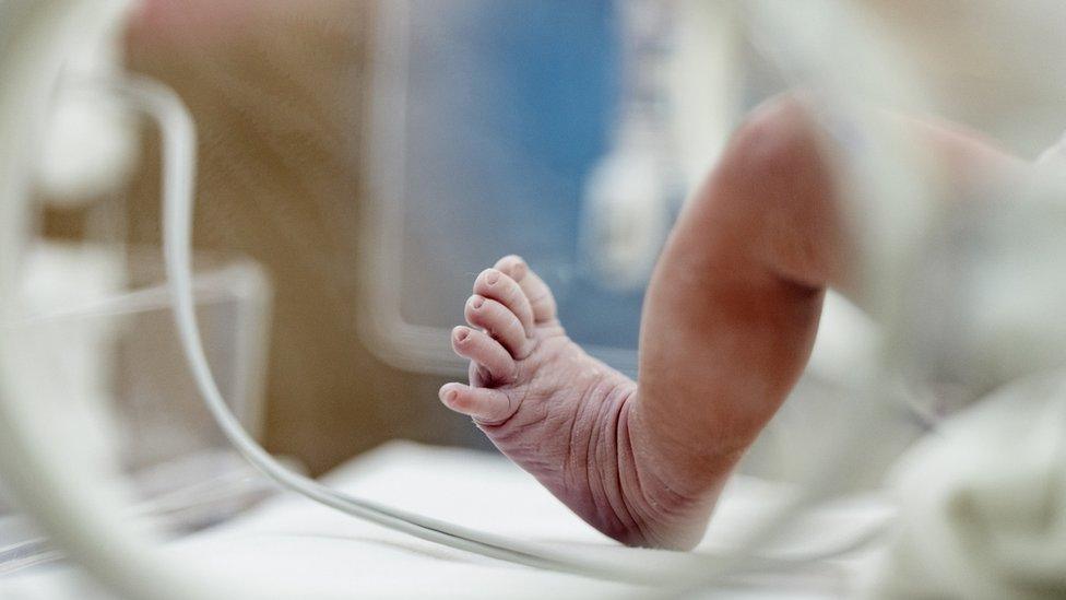 A baby in an incubator