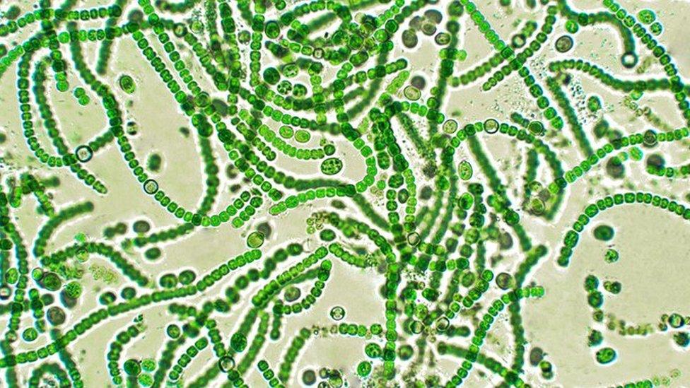 cyanobacteria under microscope - small green worms