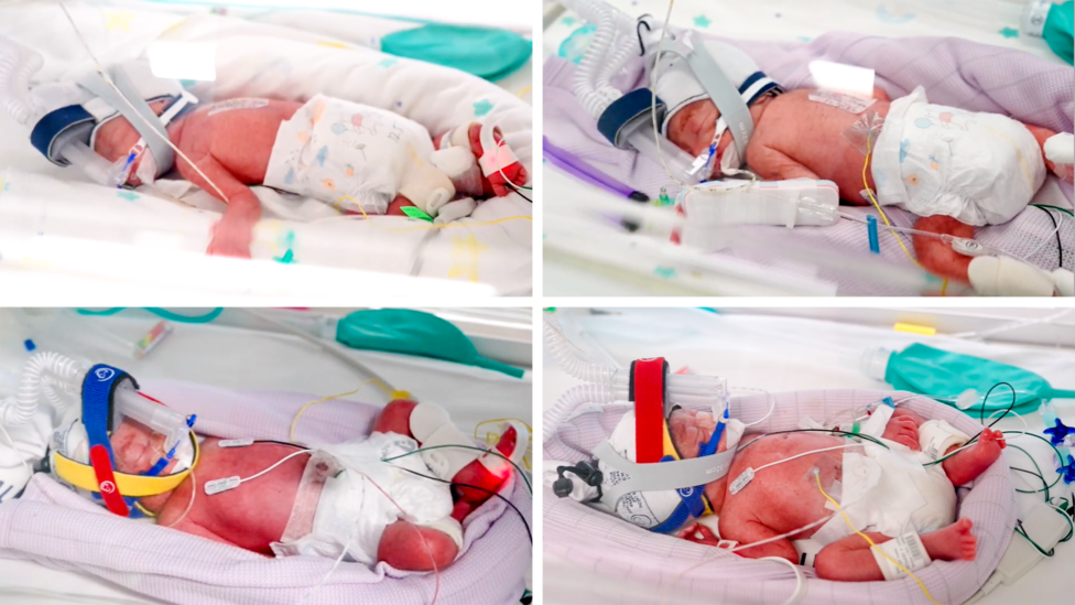 Rare identical quadruplets born in Australia