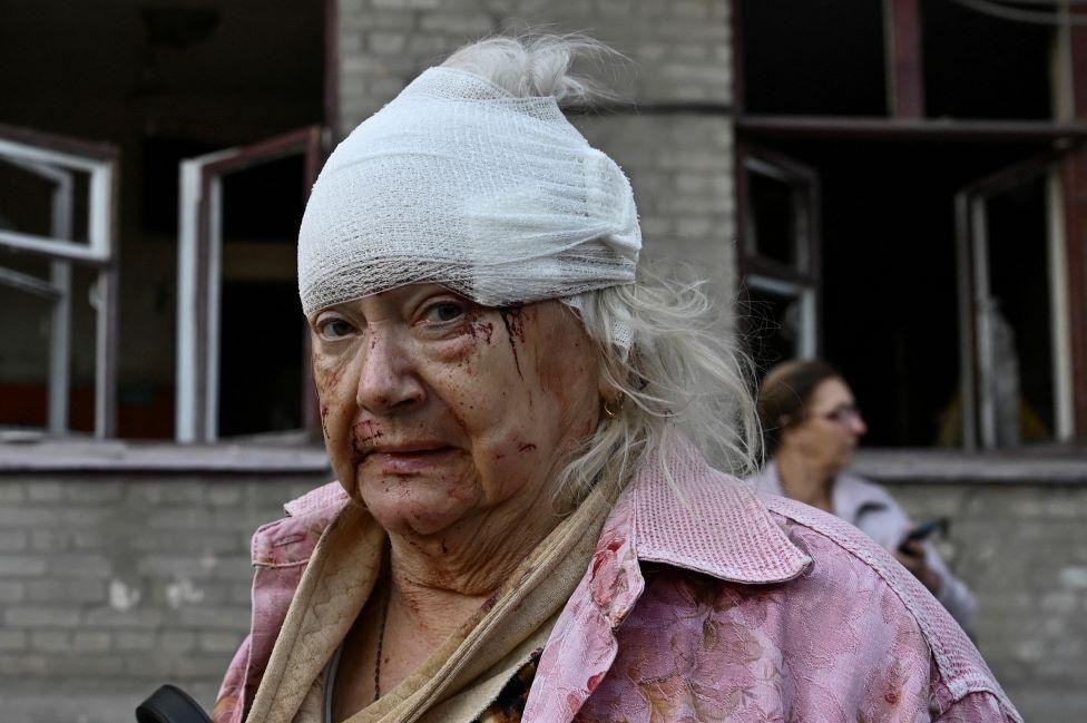 Woman called Halyna with bandaged head in front of bombed building