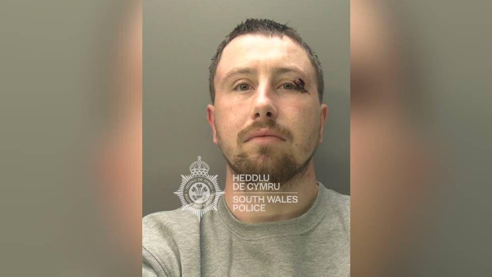 A man stood being photographed for a police mugshot. He has a gash above his left eye and is wearing a grey jumper.
