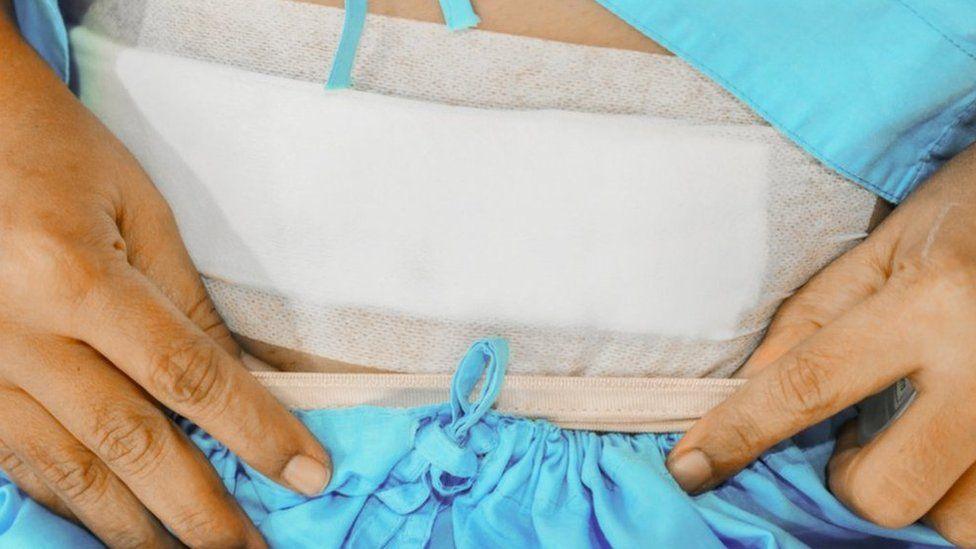 Hysterectomy 