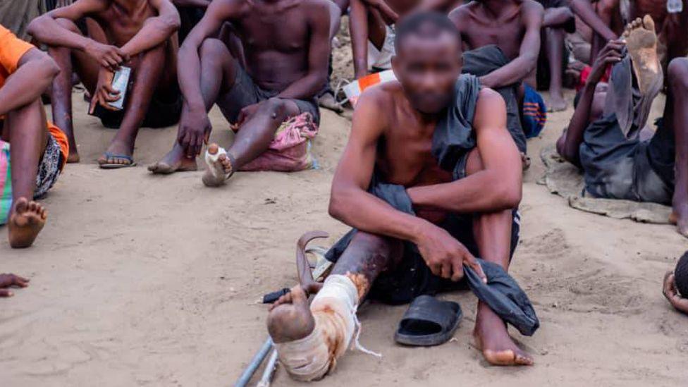 A man with his foot bandaged looks at the camera.