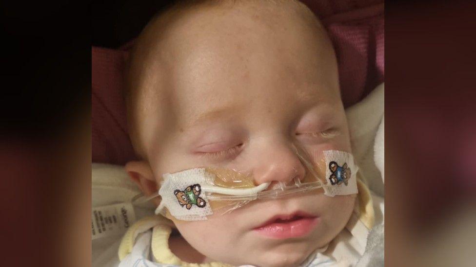 Newborn baby Theodore lying with his eyes closed and a breathing tube taped into his nose and stuck down with plasters covered in teddy bears. He is wearing a hospital gown. 