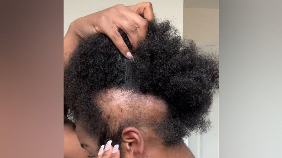 A woman with black afro hair is facing away from the camera looking down as she pulls apart her hair to reveal a bald spot on her left side