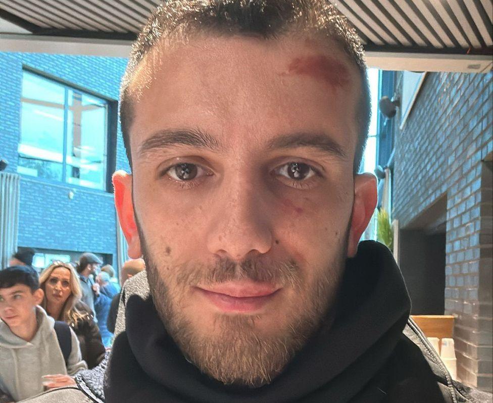 Gal Binyanmin Tshuva looking straight into the camera, with a bruise on his forehead. He has very short brown hair, a short beard and is wearing a black turtle-neck type of jacket.