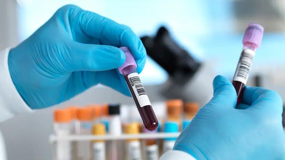 A stock picture of test tubes containing blood samples in a lab. A pair of hands with blue disposable gloves are holding a couple of tubes.