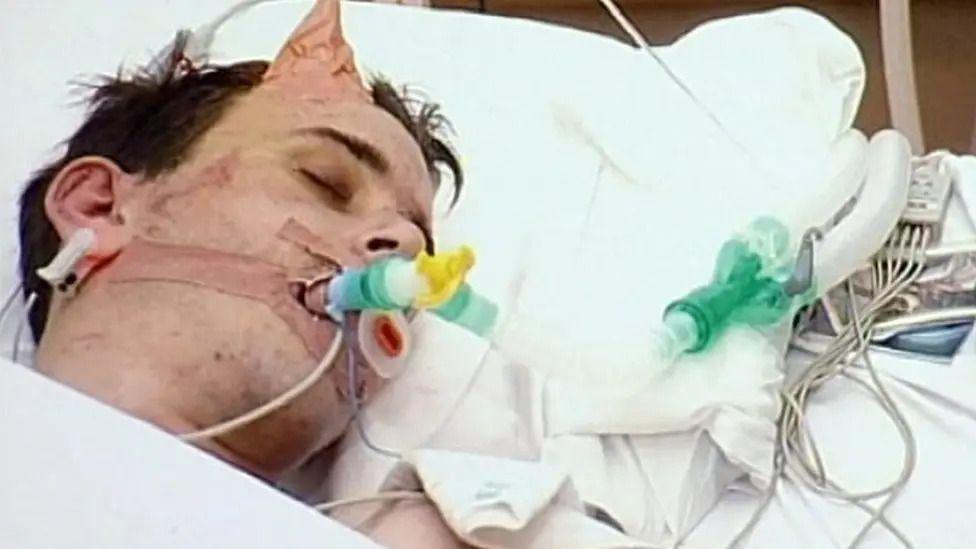 A man is seen lying in a hospital bed with tubes going into his mouth. He has brown hair and his eyes are closed.