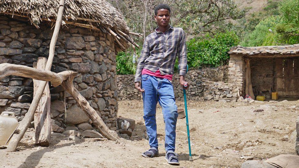 Berhane Haile, now 17, wearing a checked shirt stands outside a stone and thatched house in Seyabo. He is leaning on a crutch