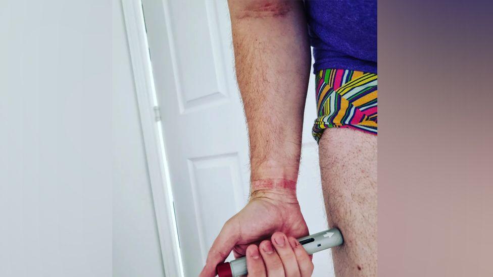 A person with skin rashes injecting their leg with a medical pen and needle