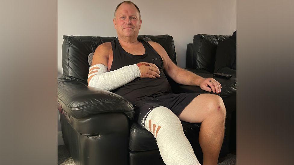 Danny sits on the black leather sofa smiling at the camera. He wears a black vest and shorts and his right forearm and leg are fully bandaged. You can see scabs where his hands and knees were hurt.