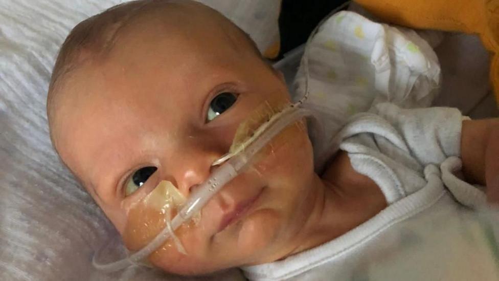 Newborn Orlando Davis, with his eyes open and a breathing tube attached to his nose with clear tape. He is wearing a white babygrow and his head is rested on what appears to be a white muslin cloth