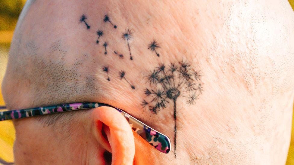 A close up of Mandy Nicolson's shaved head with little patches of hair growing through and she has a dandelion tattoo just above her ear with a few seeds flying away