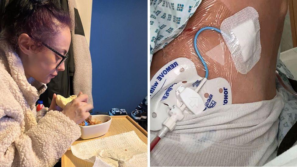 Two pictures of Maisie, the one on the left is showing her eating some food, very poorly and the one on the right is showing the tubes coming out of her kidneys