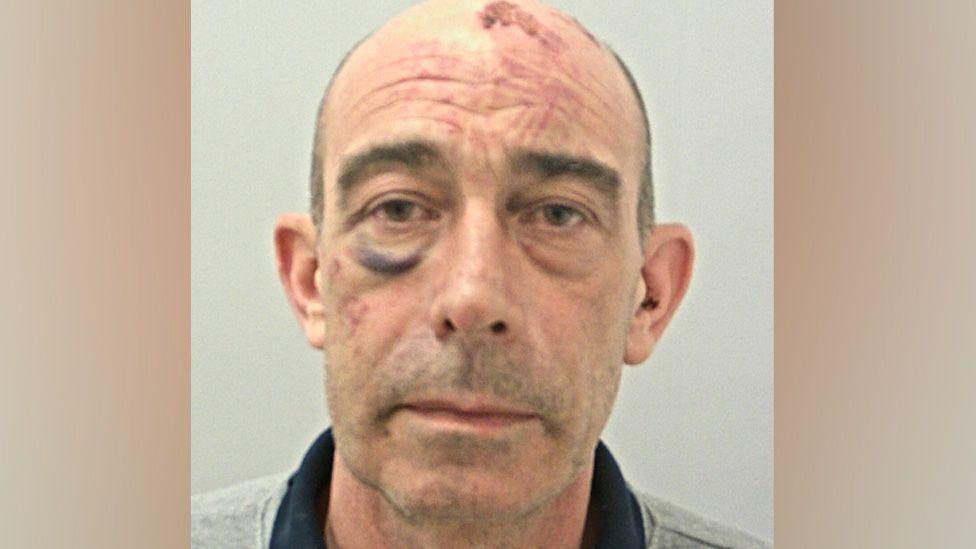 Andrew Thomson's mugshot: he has short hair, balding on top and has a black eye and injury marks on his face and top of his head