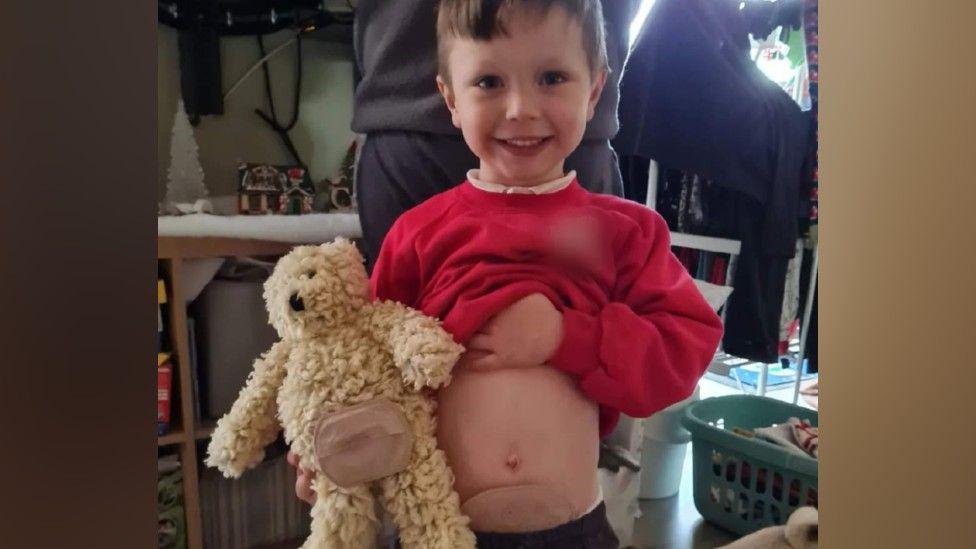 Riley holding Buttony bear. He is also holding up his red jumper, showing his stoma bag.