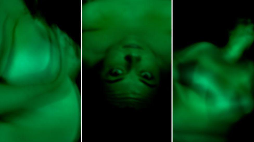 Artwork created by Phoebe Wingrove to depict the experience of traumatic birth. The work is a tryptic of three pictures showing abstract views of what you can just make out is a woman's body. The middle of the three is the clearest, with a woman's face looking up at the camera and as previously the pictures are in green and black.