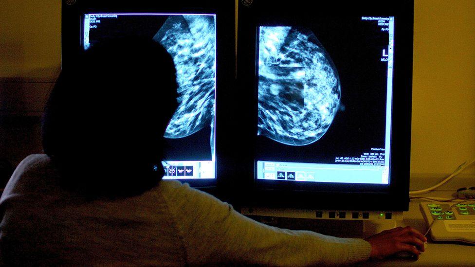 A radiographer sits in front of two screens looking at a mammogram