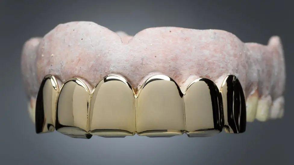 A stock image of a set of gold false teeth