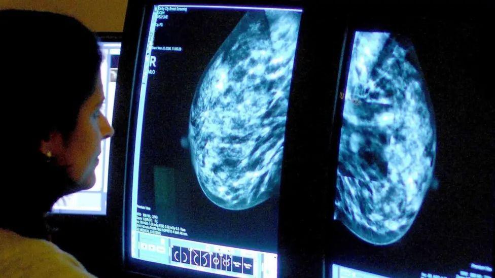 A medical professional sits and looks at an X-ray of two breasts on a large screen in order to detect the first signs of breast cancer.