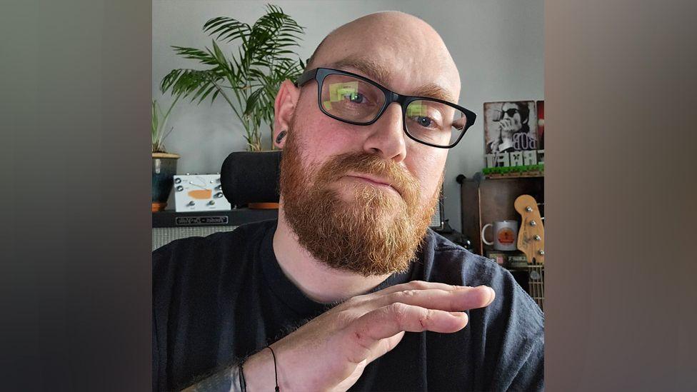 A man with brown beard and moustache, wearing black glasses and a black T-shirt, holds up his hand which has psoriasis marks