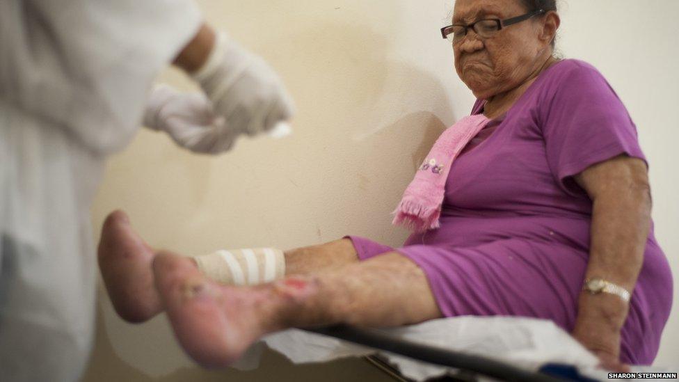 Lucia Feireira Ojamatos, 71, has her bandages changed on her infected legs at the hospital Colonia Antonio Aleixo in Manaus, Brazil on 17 March 2012