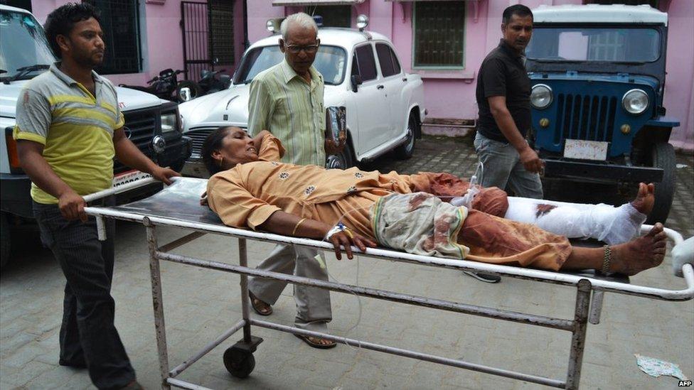 An Indian woman, who received a gunshot wound to her leg, is pictured at a hospital following communal riots between Muslims and Hindus in Muzaffarnagar