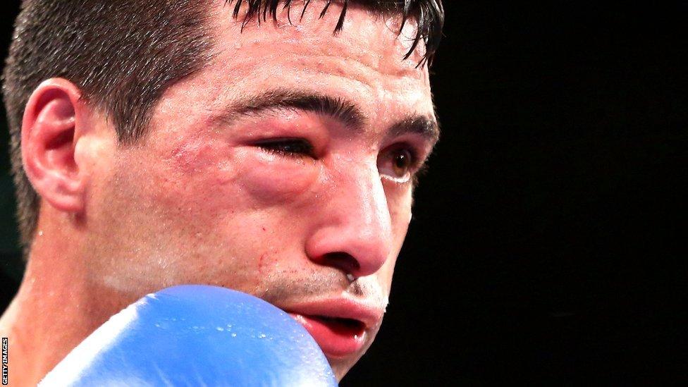 Swelling around Lucas Matthysse's right eye