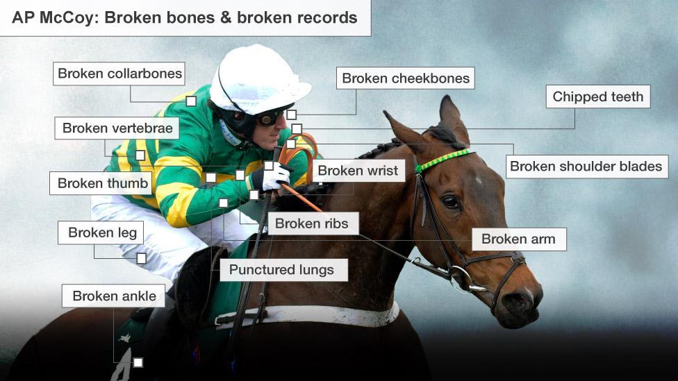 An image showing AP McCoy's broken bones - including collarbones, vertebrae, thumb, leg, cheekbones, wrist, ribs, arm, and shoulder blades