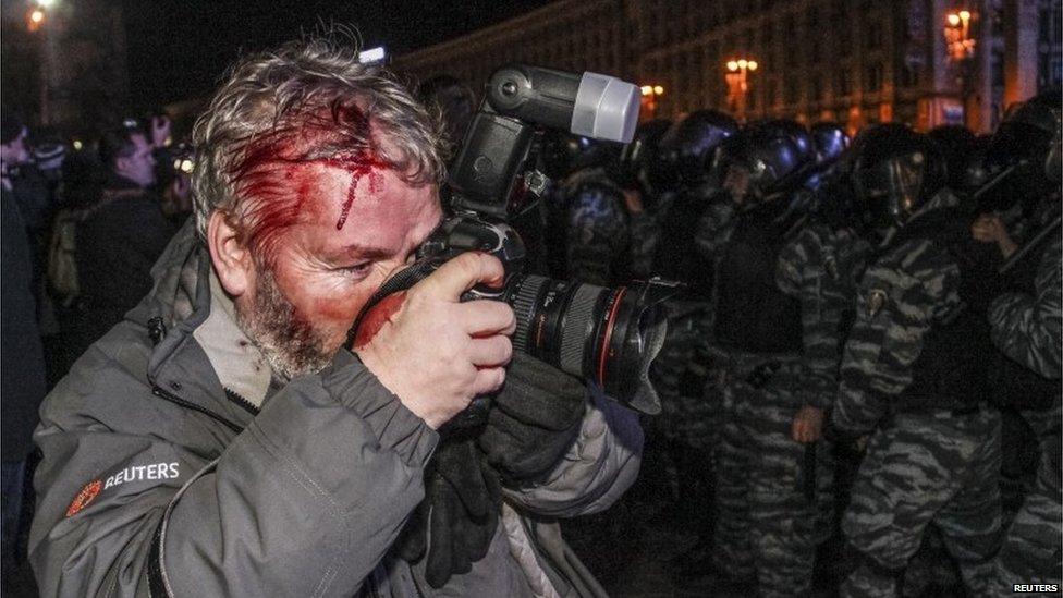 Wounded Reuters photographer Gleb Garanich, who was injured by riot police, takes pictures.