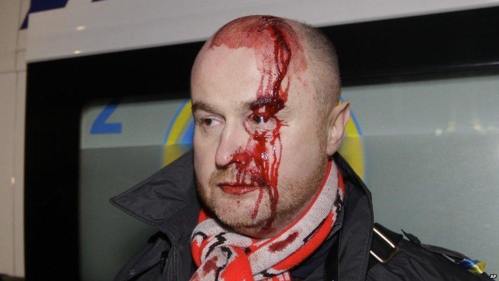 Injured protester