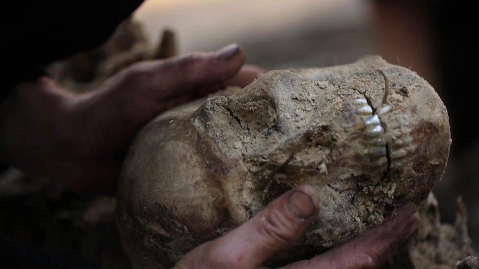 A skull found in the mass grave
