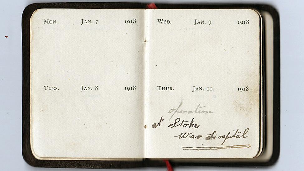 Diary reads: Jan 10 1918 - operation at Stoke War Hospital.