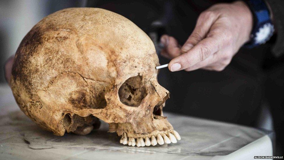 A skull is measured