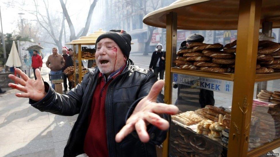 Wounded man in Ankara (12 March 2014)