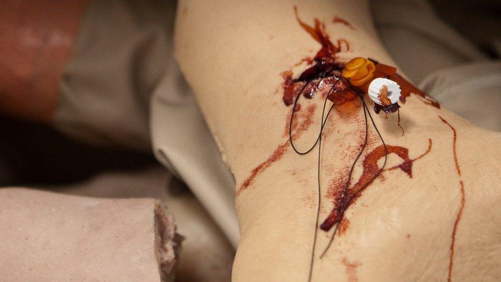 Mae'n rhaid i'r anafiadau a'r triniaethau edrych yn realistig // The injuries and treatments must look realistic