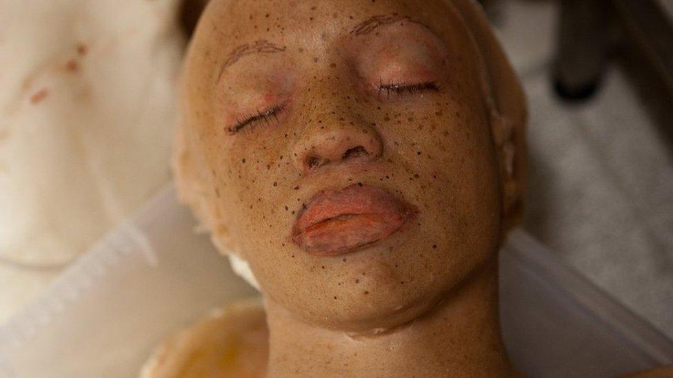 Dydi'r claf yma ddim yn edrych yn dda o gwbl // This patient doesn't look at all well!