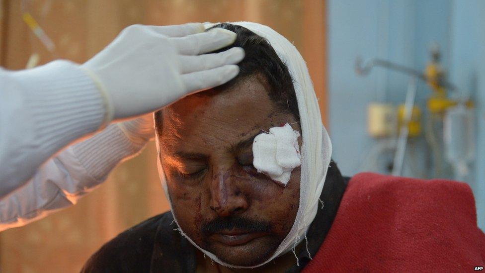 5. Indian medical staff care for an injured supporter of "Godman" Rampal Maharaj at a hospital in Hisar, some 175 kilometres (108 miles) north of New Delhi on November 18, 2014